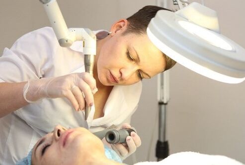 Laser removal of human papillomavirus
