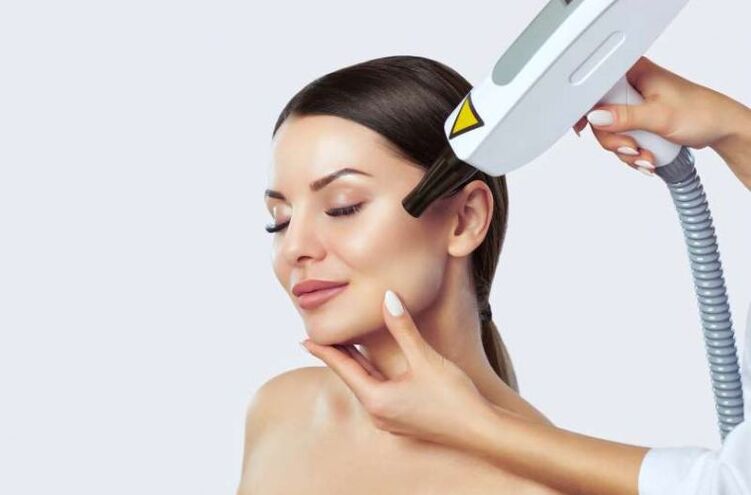 Laser removal of papillomas on the face