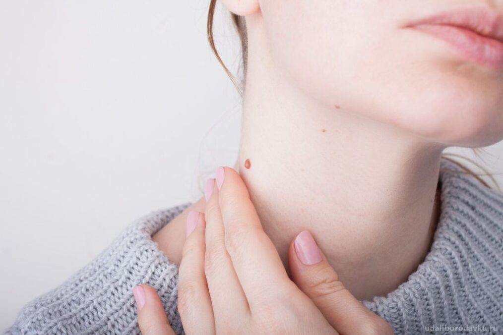 The pathogenesis of HPV